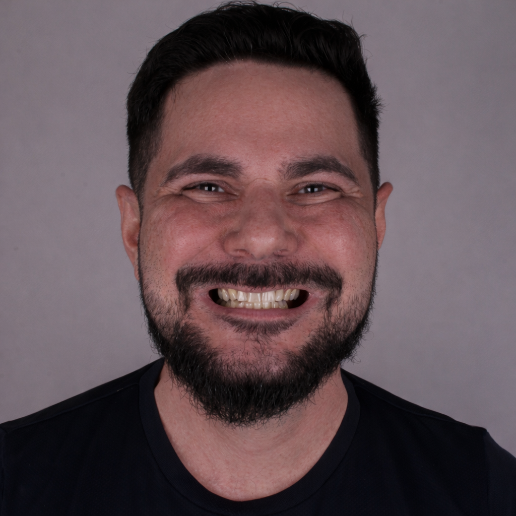 Reabilitação Total Emax - Antes